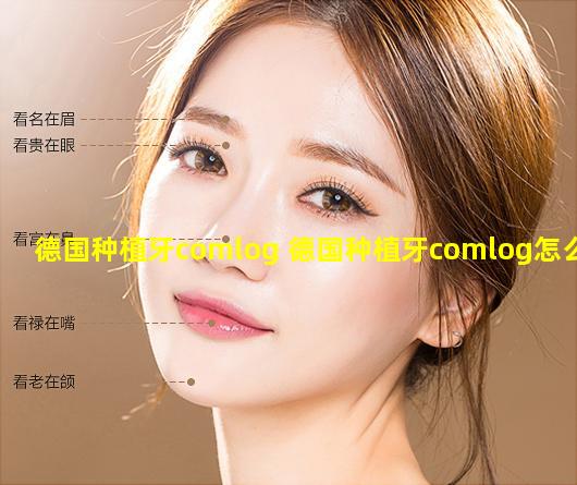 德国种植牙comlog 德国种植牙comlog怎么样